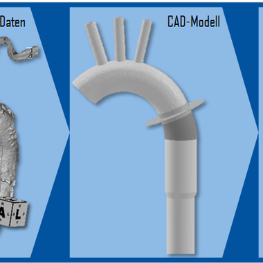 IndiTexPlant - individuelles Implantat © ITA an der RWTH Aachen
