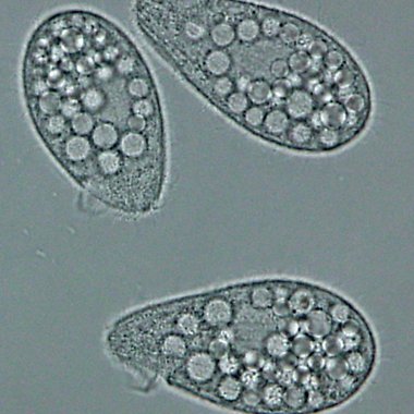 Die kleinen Einzeller wachsen weniger, wenn sie Schadstoffen ausgesetzt sind.