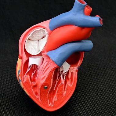 Demonstrator „Schlauchimplantat mit Herzklappenventil für den minimalinvasiven Einsatz“