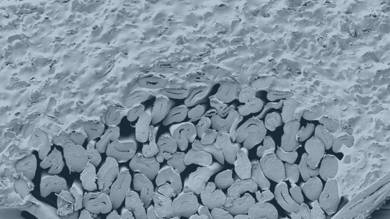 400-fache Vergrößerung eines beschichteten Baumwollgewebes im Querschnitt mit Cellulosepartikeln in der Beschichtungsmatrix.