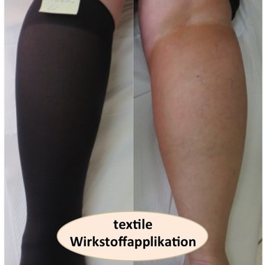 Effekt nach nur vier Stunden Tragezeit: Ein Hautbräuner in Form von befrachteten Polyelektrolytschichten zeigt eindrucksvoll seine Wirkung